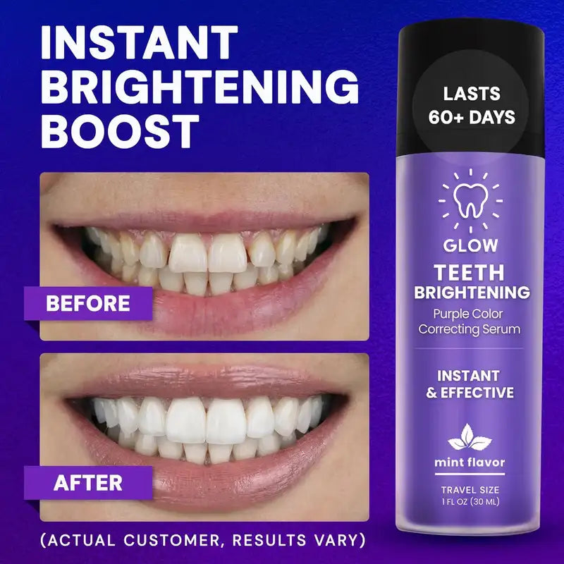 GLOW™ Teeth Brightening Purple Serum