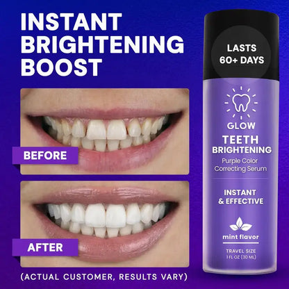 GLOW™ Teeth Brightening Purple Serum
